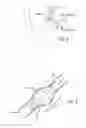 Fig. 04 - METHOD OF DELIVERING A MEDICAL DEVICE ACROSS A VALVE