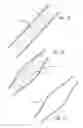 Fig. 10 - METHOD OF DELIVERING A MEDICAL DEVICE ACROSS A VALVE