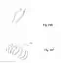 Fig. 15 - METHOD OF DELIVERING A MEDICAL DEVICE ACROSS A VALVE
