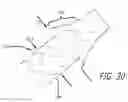 Fig. 16 - METHOD OF DELIVERING A MEDICAL DEVICE ACROSS A VALVE