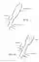Fig. 17 - METHOD OF DELIVERING A MEDICAL DEVICE ACROSS A VALVE