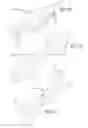 Fig. 18 - METHOD OF DELIVERING A MEDICAL DEVICE ACROSS A VALVE
