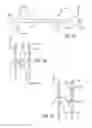 Fig. 22 - METHOD OF DELIVERING A MEDICAL DEVICE ACROSS A VALVE
