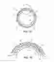 Fig. 03 - MEDICAL DEVICES AND METHODS OF MAKING THE SAME