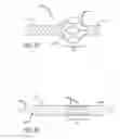 Fig. 12 - METHOD OF DELIVERING A MEDICAL DEVICE ACROSS A PLURALITY OF VALVES
