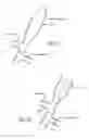 Fig. 17 - METHOD OF DELIVERING A MEDICAL DEVICE ACROSS A PLURALITY OF VALVES