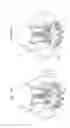 Fig. 12 - Valve prosthesis fixation techniques using sandwiching