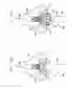 Fig. 23 - Valve prosthesis fixation techniques using sandwiching