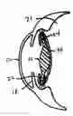 Fig. 01 - Ocular Lens