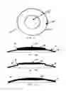 Fig. 05 - Ocular Lens