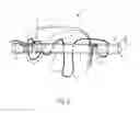 Fig. 03 - SYSTEMS AND METHODS FOR ZIPKNOT ACL FIXATION