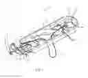 Fig. 08 - SYSTEMS AND METHODS FOR ZIPKNOT ACL FIXATION