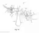 Fig. 11 - SYSTEMS AND METHODS FOR ZIPKNOT ACL FIXATION
