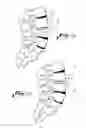 Fig. 08 - Vertebral body replacement and method of use