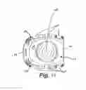 Fig. 10 - Vertebral body replacement and method of use
