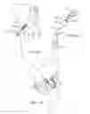 Fig. 07 - APPARATUS FOR CONTROLLING A LOAD ON A HIP JOINT