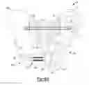 Fig. 06 - Prosthetic hip device and associated method
