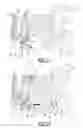 Fig. 08 - Prosthetic hip device and associated method
