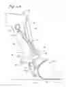 Fig. 05 - Implement with linkage assembly and work assembly wherein work assembly has dynamic skid shoe and a scraping edge