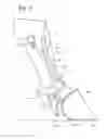 Fig. 09 - Implement with linkage assembly and work assembly wherein work assembly has dynamic skid shoe and a scraping edge