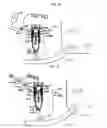 Fig. 24 - Implement with linkage assembly and work assembly wherein work assembly has dynamic skid shoe and a scraping edge