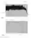 Fig. 03 - HAIRSCAN FOR GROWTH ANALYSIS