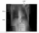 Fig. 01 - METHOD AND SYSTEM FOR IMAGING PATIENTS WITH A PERSONAL MEDICAL DEVICE