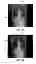 Fig. 05 - METHOD AND SYSTEM FOR IMAGING PATIENTS WITH A PERSONAL MEDICAL DEVICE