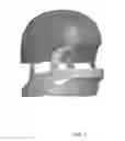 Fig. 02 - LONG FIBER THERMOPLASTIC HELMET INSERTS AND HELMETS AND METHODS OF MAKING EACH