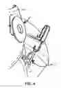 Fig. 03 - APPARATUS FOR MAINTAINING A ZIPPER IN A CLOSED POSITION