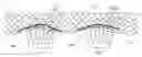 Fig. 01 - METHOD FOR OVER WINTERING ROOT CROPS