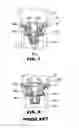 Fig. 05 - MANUFACTURING METHOD FOR DIFFUSER