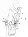 Fig. 02 - Fuel level sender protector