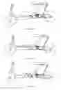 Fig. 07 - RECIPROCATING-TYPE VARIABLE-SPEED PEDAL STRUCTURE FOR SCOOTER