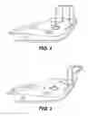Fig. 02 - Easy-up swim handles