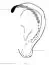 Fig. 02 - EAR LOBE SUPPORT FOR HEAVY EARRINGS WEARERS