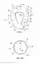 Fig. 02 - Dynamic infant head support