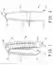 Fig. 02 - Barrette without spring member