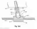 Fig. 22 - Cutting element apparatuses, drill bits including same, methods of cutting, and methods of rotating a cutting element