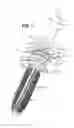 Fig. 04 - Wringer for product applicator, application assembly comprising such a wringer, and its use in cosmetics