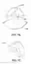 Fig. 09 - Multi-arm gimbal system