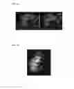 Fig. 02 - Simultaneous orthogonal light sheet microscopy and computed optical tomography