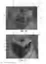 Fig. 02 - Cube puzzle game