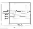 Fig. 07 - Means and associated methods for digitally controlling converter systems
