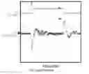 Fig. 08 - Means and associated methods for digitally controlling converter systems