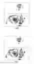 Fig. 06 - Method for detecting a covered dielectric object