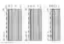 Fig. 07 - Mechanical resonating structures including a temperature compensation structure