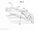 Fig. 06 - Lens with compound linear-convex meniscus wall