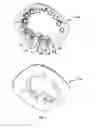 Fig. 02 - RETROFIT SYSTEM FOR CONVERTING AN EXISTING LUMINAIRE INTO A SOLID STATE LIGHTING LUMINAIRE