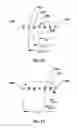 Fig. 10 - Interpolation of video compression frames